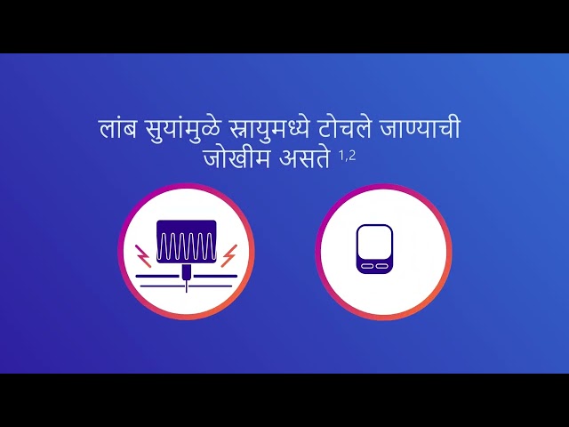 Needle Length Marathi